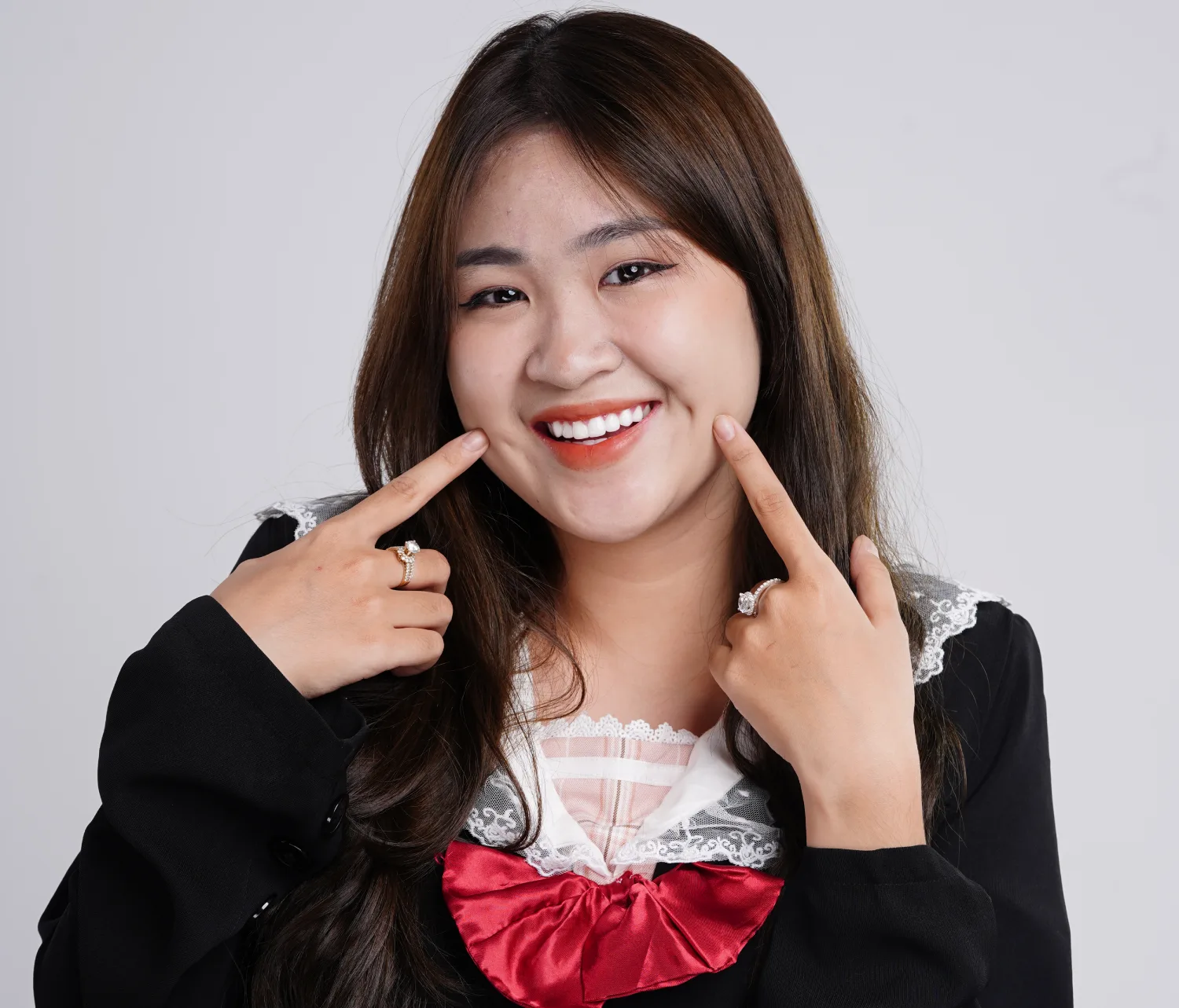 Nha Khoa Dentos: Địa chỉ khắc phục tình trạng bọc răng sứ bị hỏng an toàn, hiệu quả